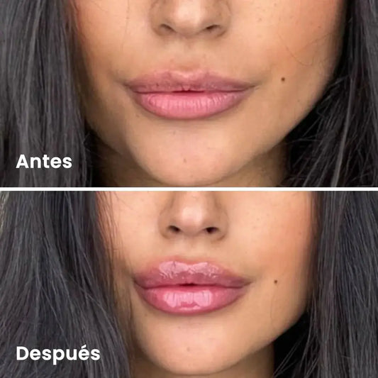 Voluminizador de Labios - Oferta Limitada 2x1
